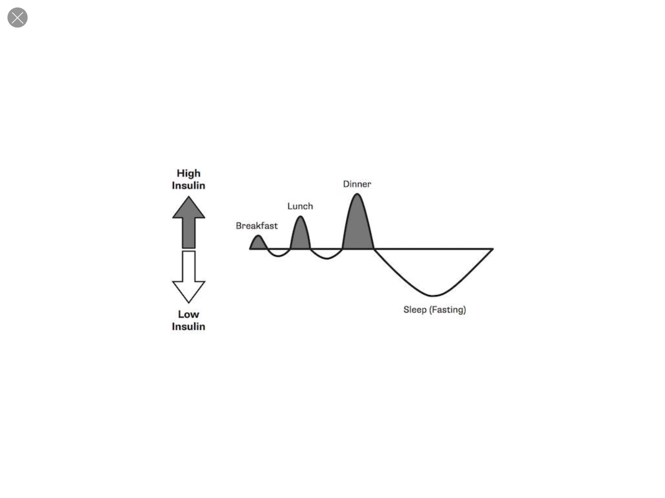 Picture of What Causes Insulin Resistance? | Reversing Diabetes